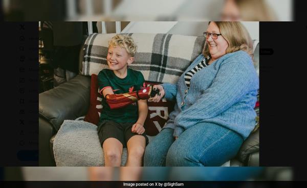 10-Year-Old Receives 'Iron Man'-Themed Bio<em></em>nic Arm In UK